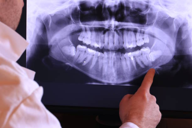 Best Emergency Root Canal Treatment in Timberville, VA