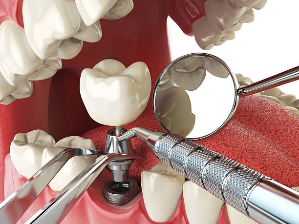 Best Emergency Root Canal Treatment in Timberville, VA